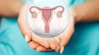 Kista Raksasa Sebesar Bayi Tersembunyi di Perut Wanita
